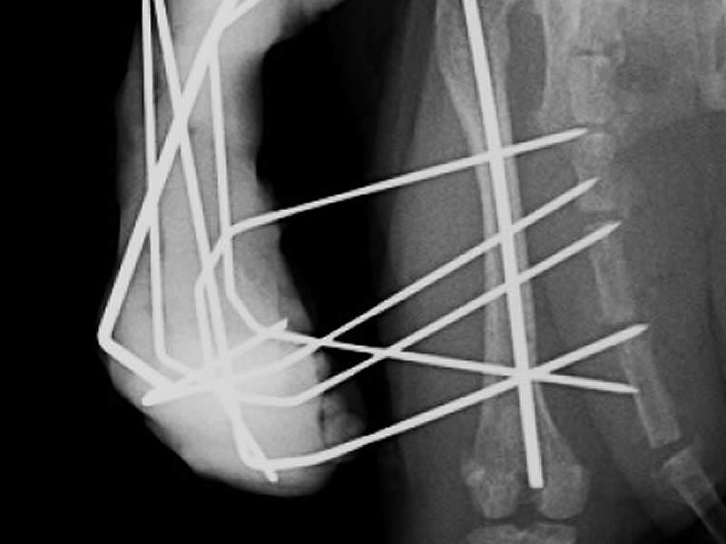 フェレット 大腿骨骨折整復