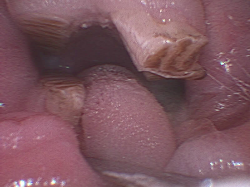 チンチラ 臼歯不正咬合