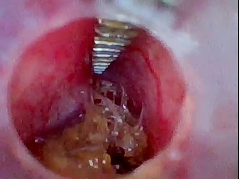 ゴールデンハムスター 結腸内異物摘出